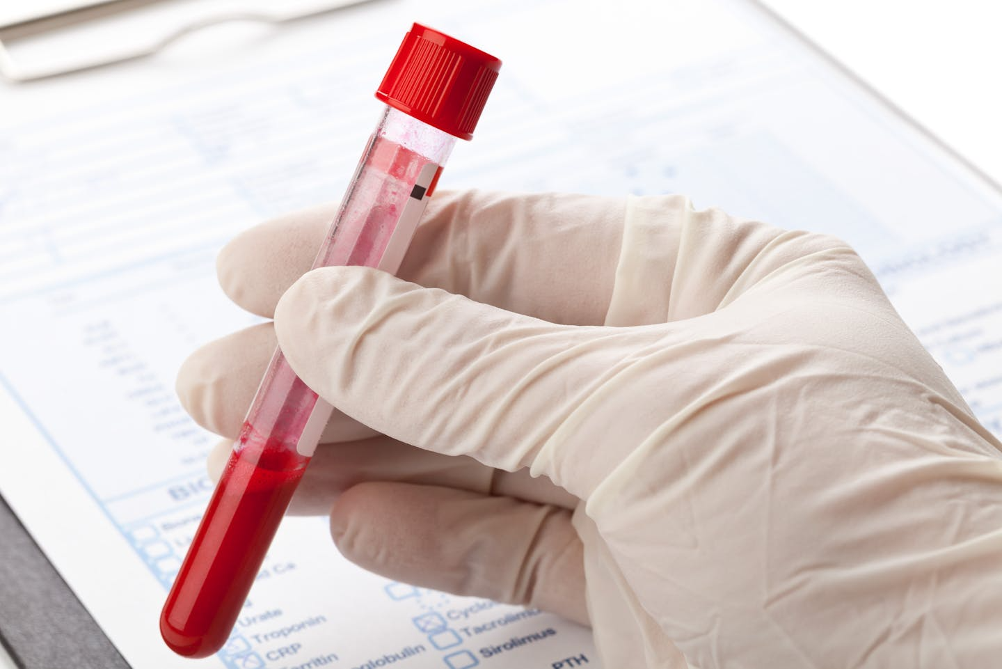 blood-sample-img